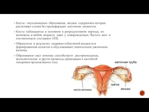 Кисты - опухолевидные образования, жидкое содержимое которых растягивает стенки без пролиферации