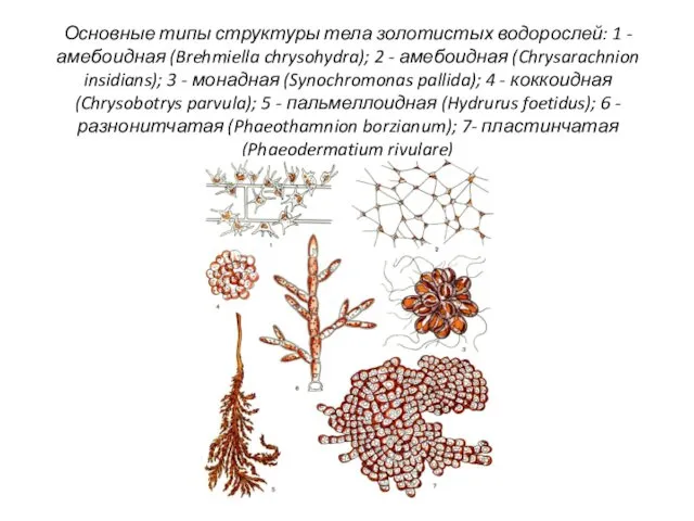 Основные типы структуры тела золотистых водорослей: 1 - амебоидная (Brehmiella chrysohydra);