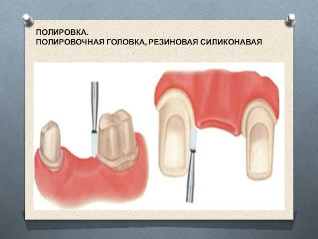 ПОЛИРОВКА. ПОЛИРОВОЧНАЯ ГОЛОВКА, РЕЗИНОВАЯ СИЛИКОНАВАЯ