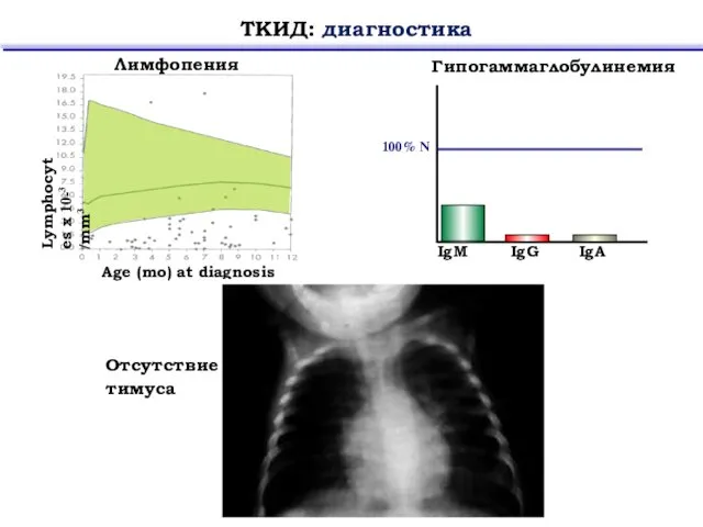 ТКИД: диагностика Гипогаммаглобулинемия