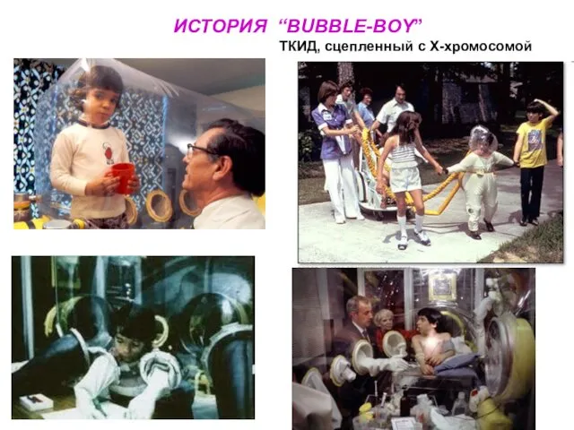 ИСТОРИЯ “BUBBLE-BOY” ТКИД, сцепленный с Х-хромосомой