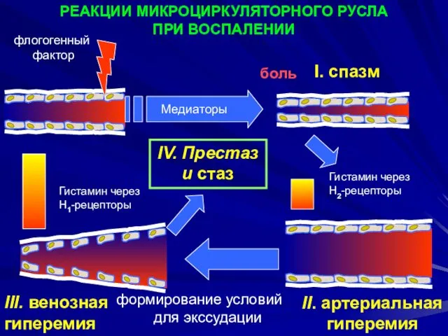 РЕАКЦИИ МИКРОЦИРКУЛЯТОРНОГО РУСЛА ПРИ ВОСПАЛЕНИИ флогогенный фактор боль Медиаторы I. спазм