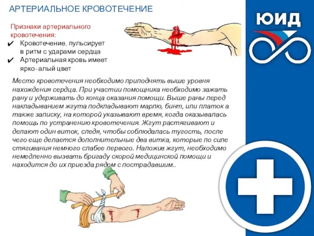 АРТЕРИАЛЬНОЕ КРОВОТЕЧЕНИЕ Место кровотечения необходимо приподнять выше уровня нахождения сердца. При