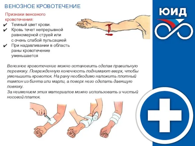 ВЕНОЗНОЕ КРОВОТЕЧЕНИЕ Венозное кровотечение можно остановить сделав правильную перевязку. Поврежденную конечность