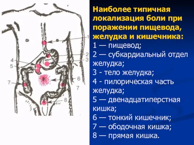 Наиболее типичная локализация боли при поражении пищевода, желудка и кишечника: 1