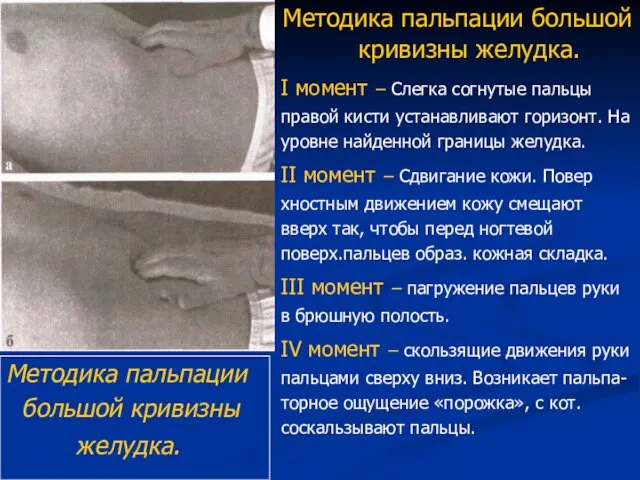 Методика пальпации большой кривизны желудка. I момент – Слегка согнутые пальцы