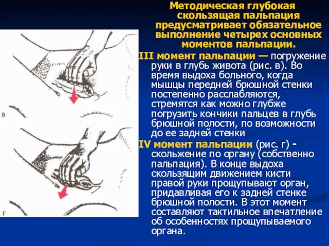 Методическая глубокая скользящая пальпация предусматривает обязательное выполнение четырех основных моментов пальпации.