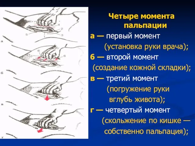 Четыре момента пальпации а — первый момент (установка руки врача); 6