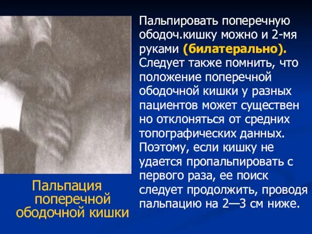 Пальпация поперечной ободочной кишки Пальпировать поперечную ободоч.кишку можно и 2-мя руками