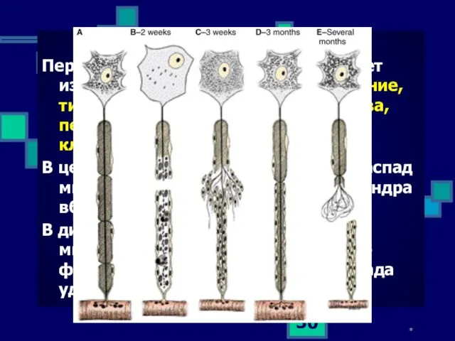 * Реакция нейронов на травму. Перерезка нервного волокна вызывает изме-нения в