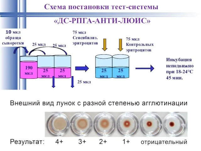 Схема постановки тест-системы «ДС-РПГА-АНТИ-ЛЮИС» Учет результатов 10 мкл образца сыворотки 75