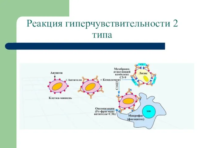 Реакция гиперчувствительности 2 типа