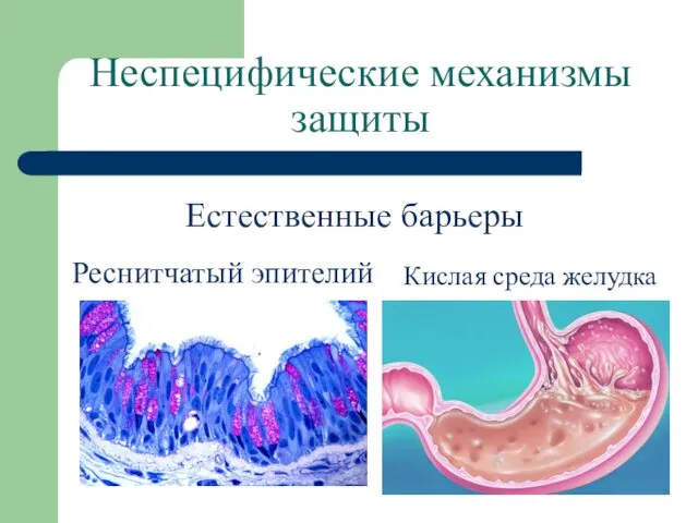 Неспецифические механизмы защиты Естественные барьеры Реснитчатый эпителий Кислая среда желудка
