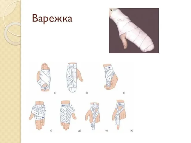 Варежка