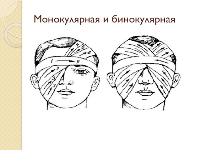 Монокулярная и бинокулярная