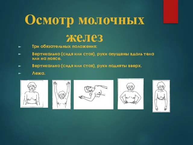 Осмотр молочных желез Три обязательных положения: Вертикально (сидя или стоя), руки