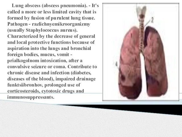 Lung abscess (abscess pneumonia). - It's called a more or less