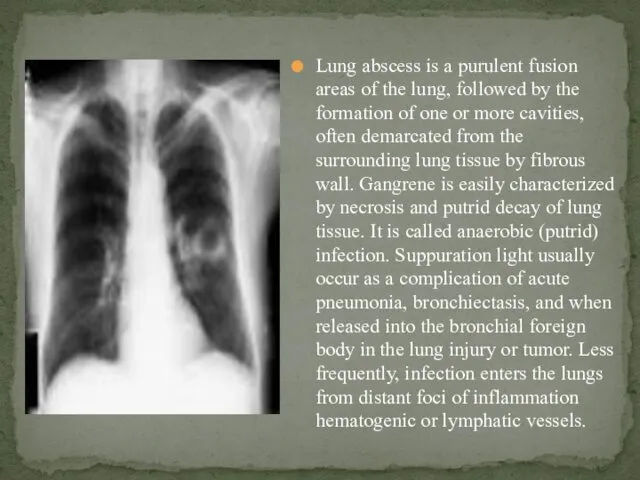 Lung abscess is a purulent fusion areas of the lung, followed