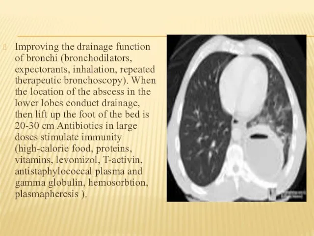 Improving the drainage function of bronchi (bronchodilators, expectorants, inhalation, repeated therapeutic