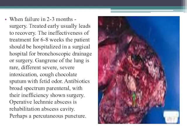 When failure in 2-3 months - surgery. Treated early usually leads