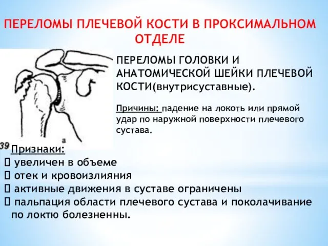 ПЕРЕЛОМЫ ПЛЕЧЕВОЙ КОСТИ В ПРОКСИМАЛЬНОМ ОТДЕЛЕ ПЕРЕЛОМЫ ГОЛОВКИ И АНАТОМИЧЕСКОЙ ШЕЙКИ