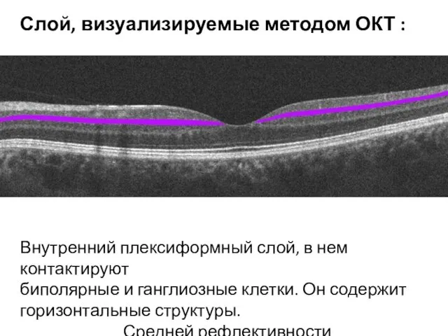 Внутренний плексиформный слой, в нем контактируют биполярные и ганглиозные клетки. Он