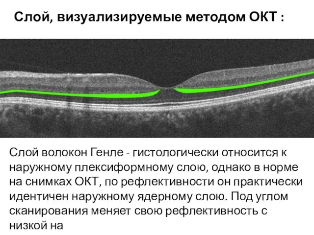 Слой волокон Генле - гистологически относится к наружному плексиформному слою, однако