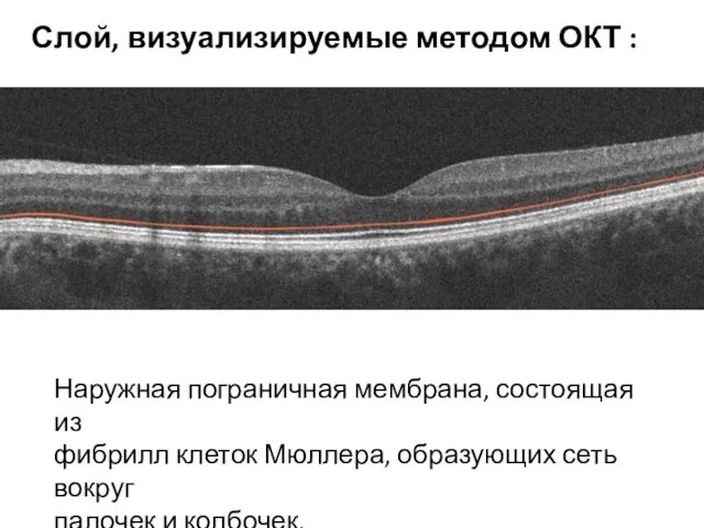 Наружная пограничная мембрана, состоящая из фибрилл клеток Мюллера, образующих сеть вокруг