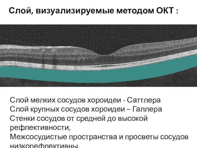 Слой мелких сосудов хороидеи - Саттлера Слой крупных сосудов хороидеи –