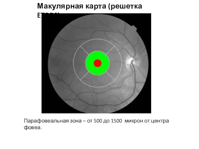 Макулярная карта (решетка ETDRS) Парафовеальная зона – от 500 до 1500 микрон от центра фовеа.