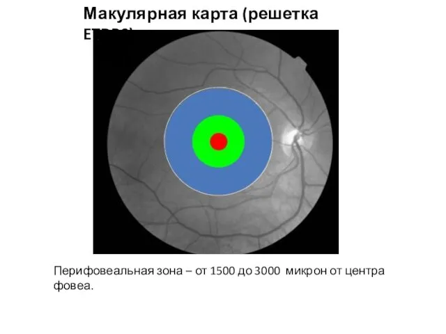 Макулярная карта (решетка ETDRS) Перифовеальная зона – от 1500 до 3000 микрон от центра фовеа.