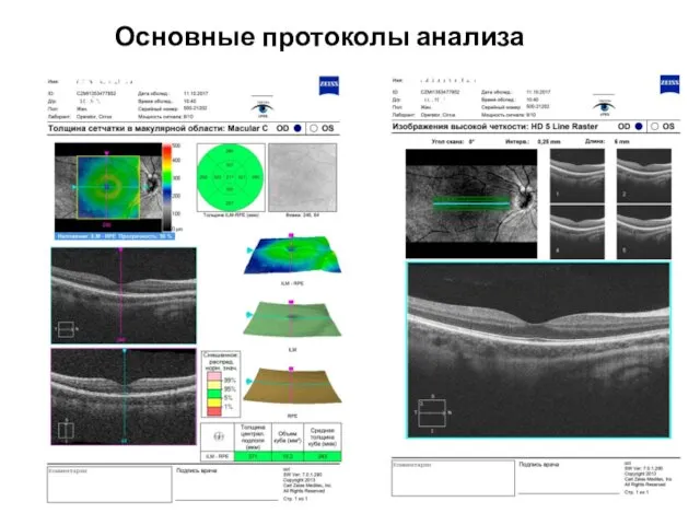 Основные протоколы анализа макулы