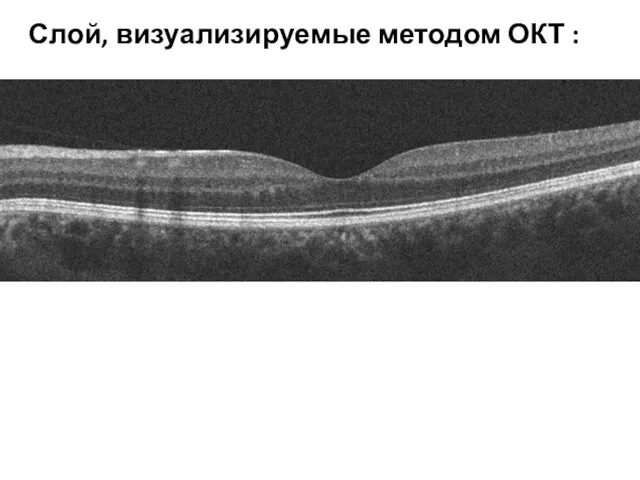 Слой, визуализируемые методом ОКТ :