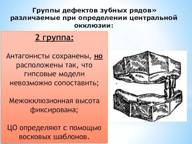 Группы дефектов зубных рядов» различаемые при определении центральной окклюзии: 2 группа: