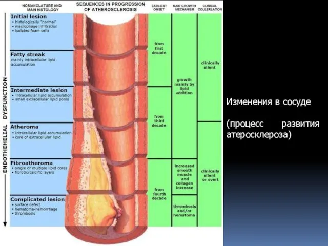 Изменения в сосуде (процесс развития атеросклероза)