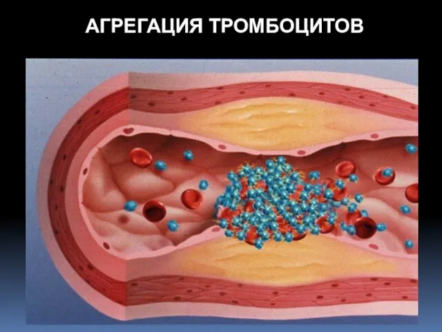 АГРЕГАЦИЯ ТРОМБОЦИТОВ