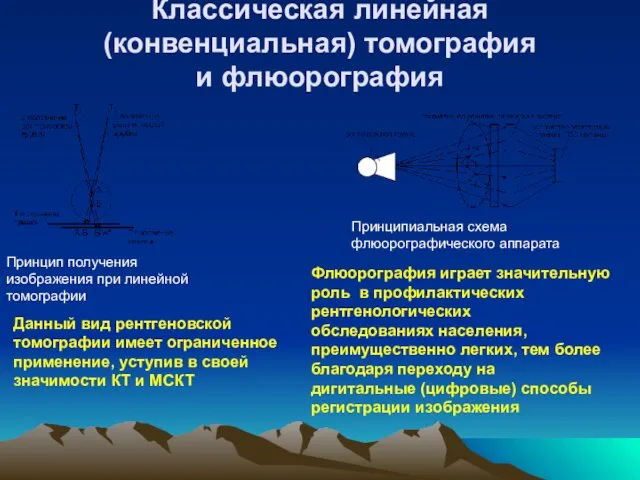 Классическая линейная (конвенциальная) томография и флюорография Принцип получения изображения при линейной