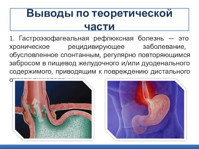 Выводы по теоретической части 1. Гастроэзофагеальная рефлюксная болезнь — это хроническое