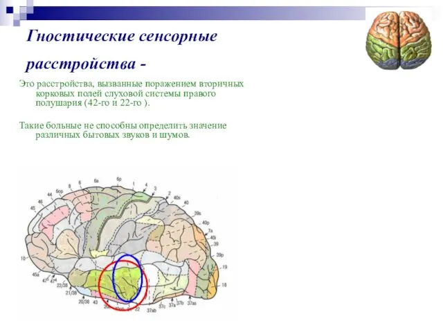 Гностические сенсорные расстройства - Это расстройства, вызванные поражением вторичных корковых полей