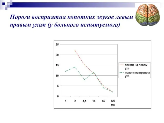 Пороги восприятия копотких звуков левым и правым ухом (у больного испытуемого)