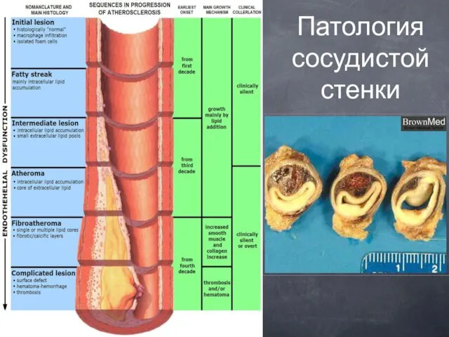 Патология сосудистой стенки