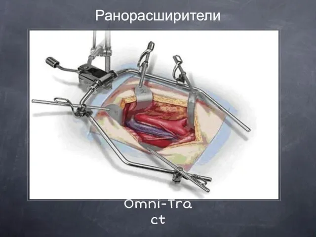 Omni-Tract Ранорасширители