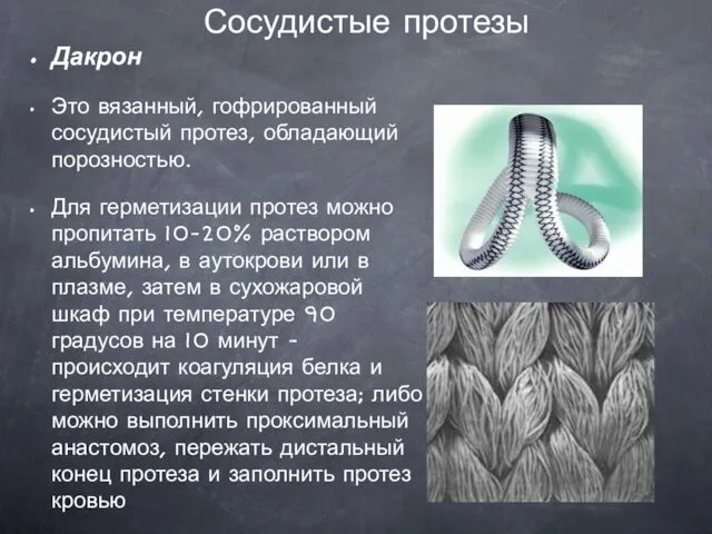 Сосудистые протезы Дакрон Это вязанный, гофрированный сосудистый протез, обладающий порозностью. Для