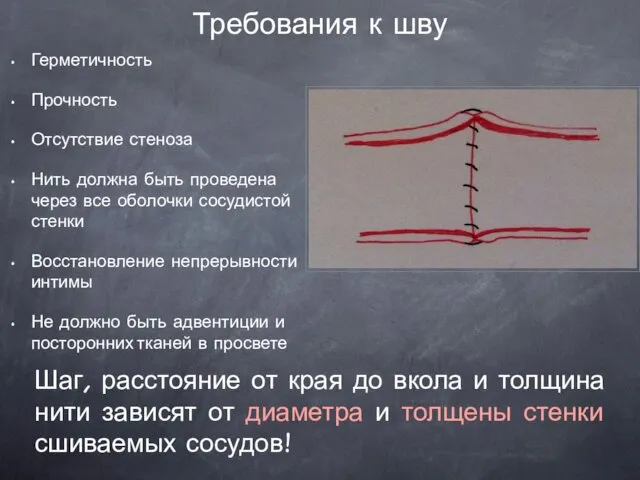 Требования к шву Герметичность Прочность Отсутствие стеноза Нить должна быть проведена