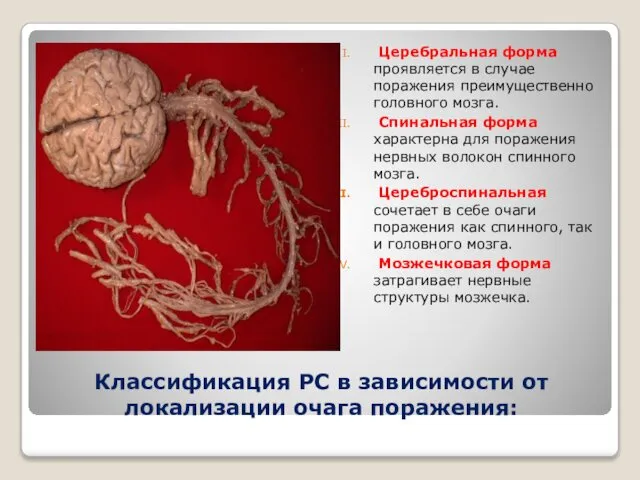 Классификация РС в зависимости от локализации очага поражения: Церебральная форма проявляется