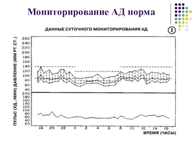 Мониторирование АД норма