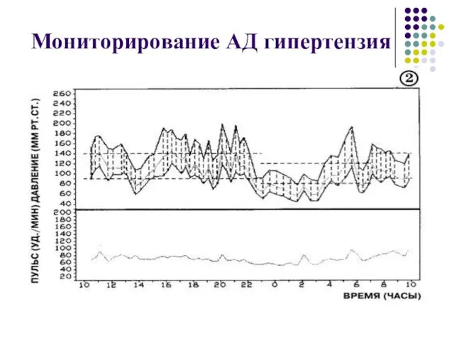 Мониторирование АД гипертензия