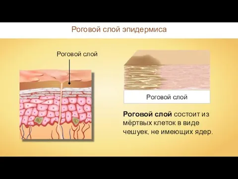 Роговой слой эпидермиса Роговой слой Роговой слой состоит из мёртвых клеток