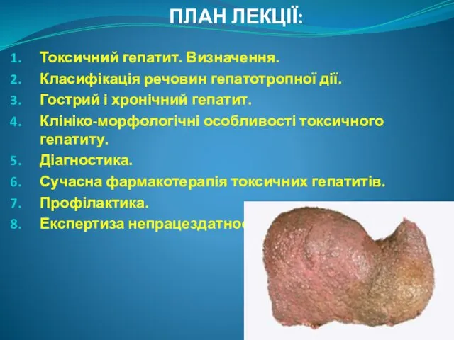 ПЛАН ЛЕКЦІЇ: Токсичний гепатит. Визначення. Класифікація речовин гепатотропної дії. Гострий і