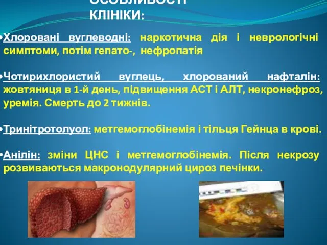 ОСОБЛИВОСТІ КЛІНІКИ: Хлоровані вуглеводні: наркотична дія і неврологічні симптоми, потім гепато-,